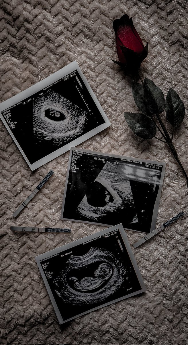 JamrozTesa's tweet photo. Would've been 20 weeks today with my son.  I miss you so much, baby B 💙👼🏻 https://t.co/GpzKEiUNcI