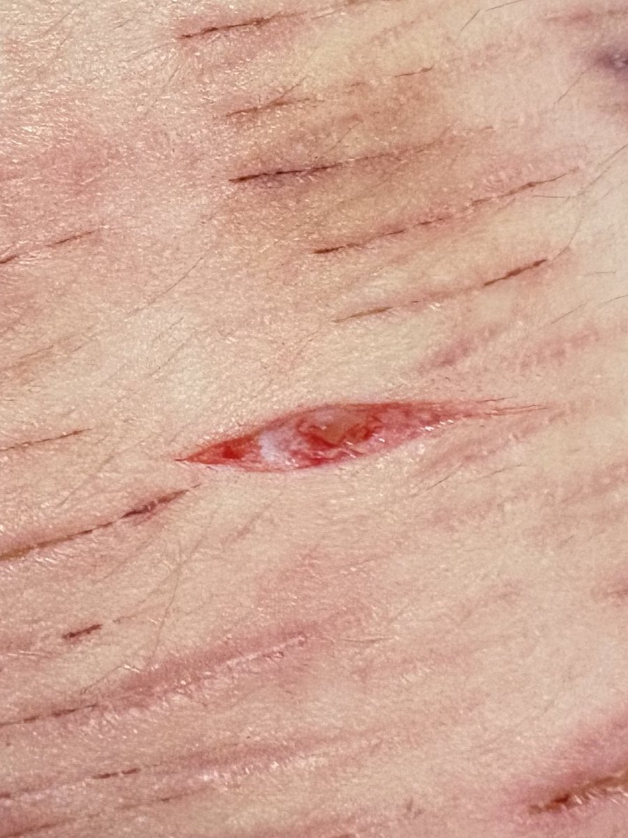 ๐ธ๐๐๐๐๐ฑ๐๐๐๐ ๐บ๐ ๐พ๐๐๐๐ tweet media