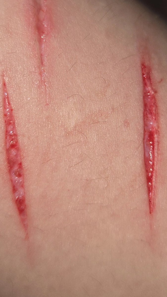 alice :3 tweet media