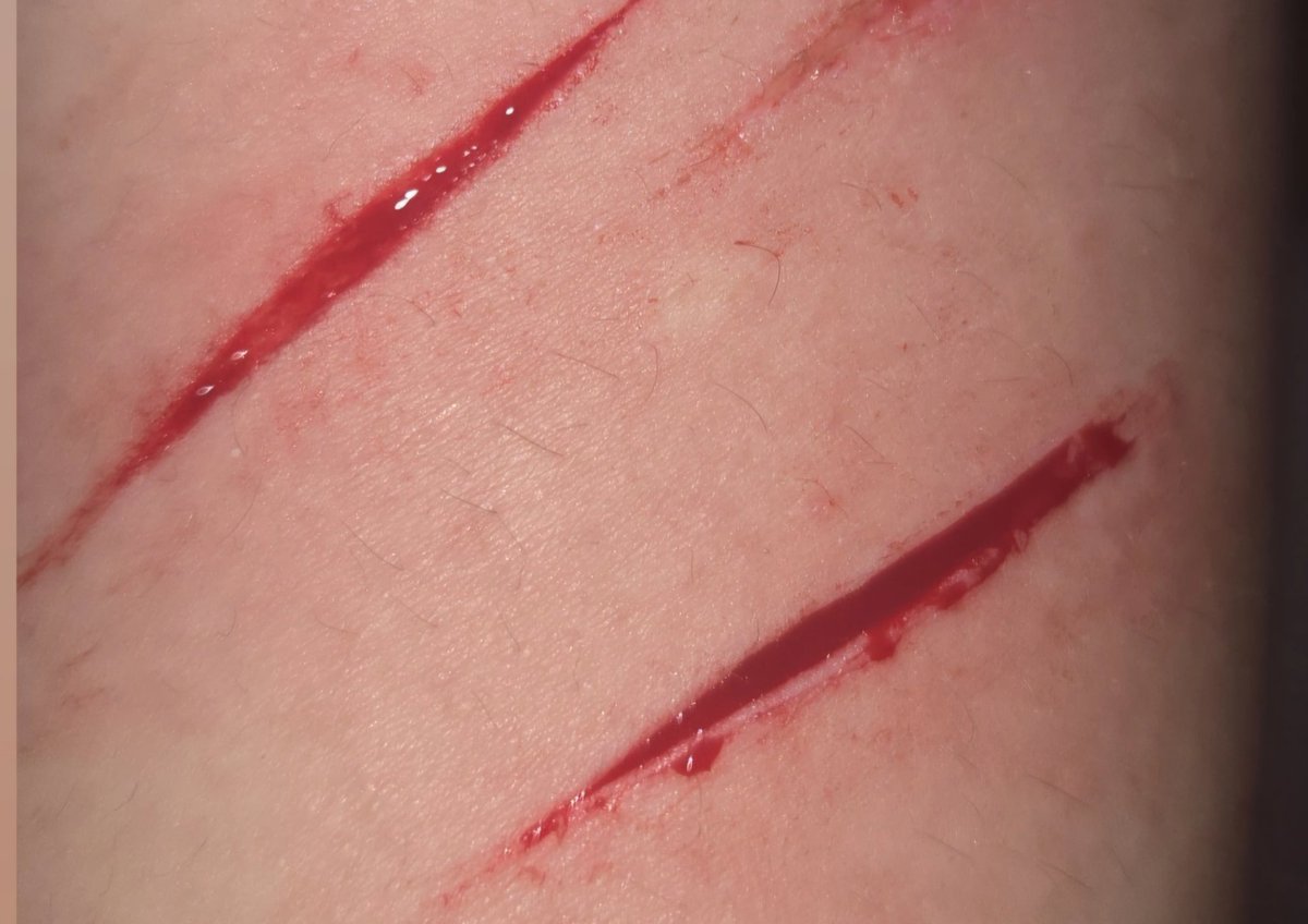 alice :3 tweet media