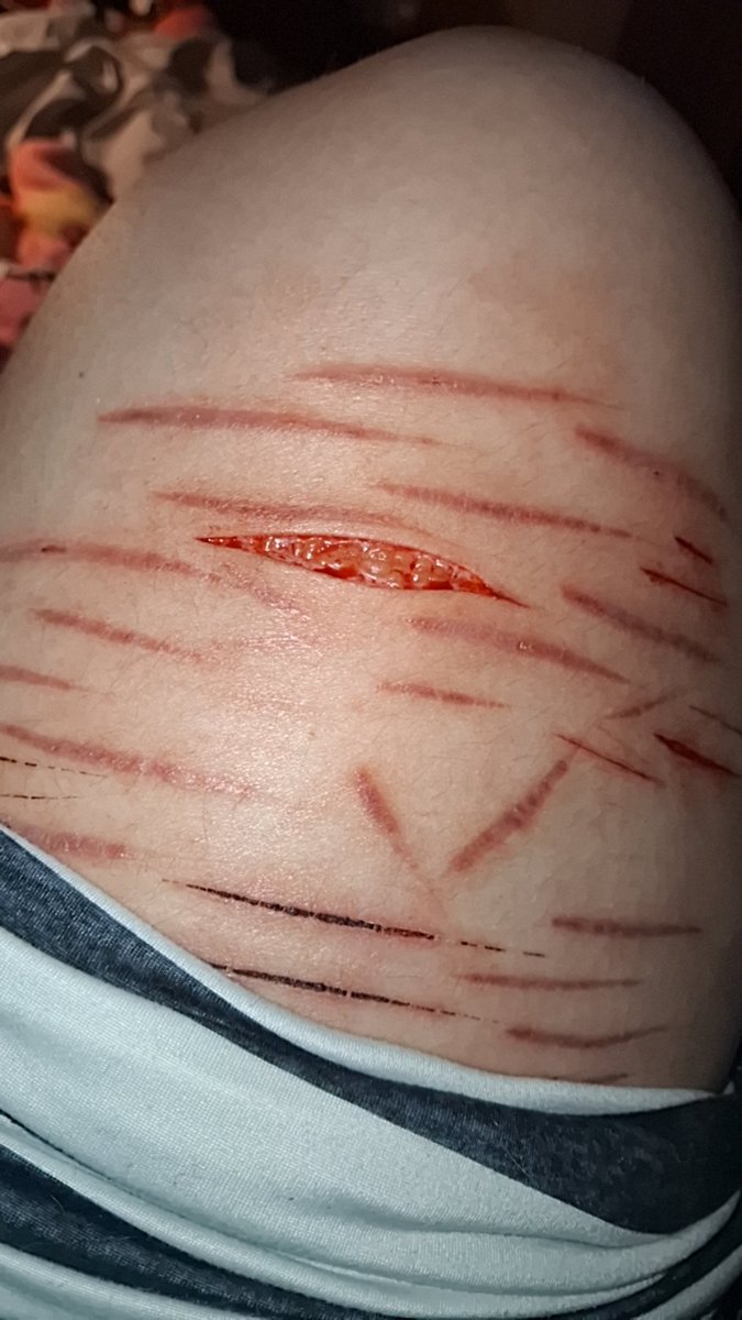 Mimi (。･´д`･。) tweet media