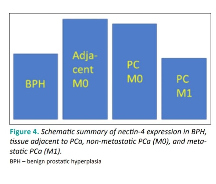 CEJUrol's tweet photo. Topographical and stage-related expression of nectin-4 in prostate cancer

In the new issue of CEJU 79(2)
by
@RadionGaraz https://t.co/udGYvqrZRP