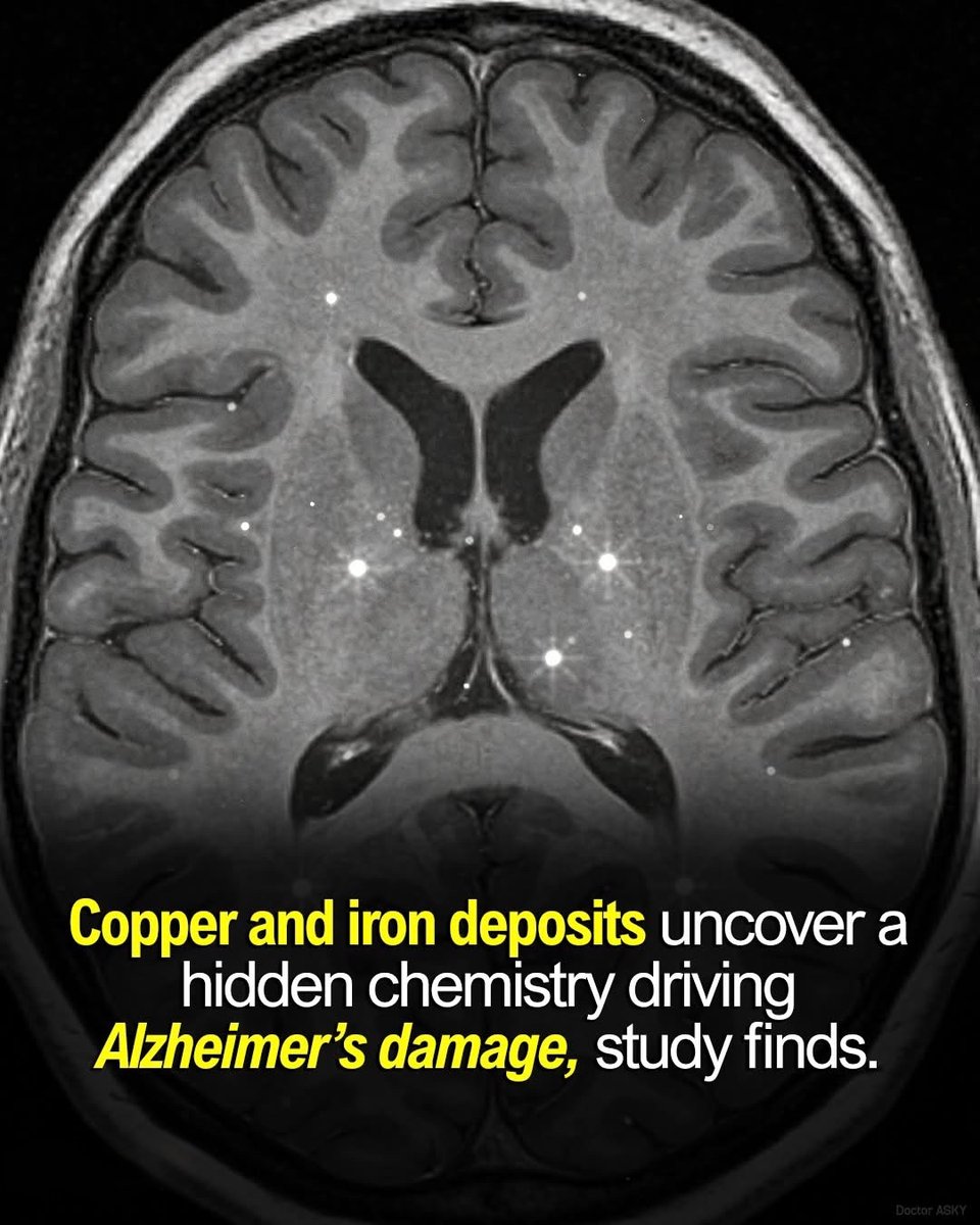 Brainy Science tweet media