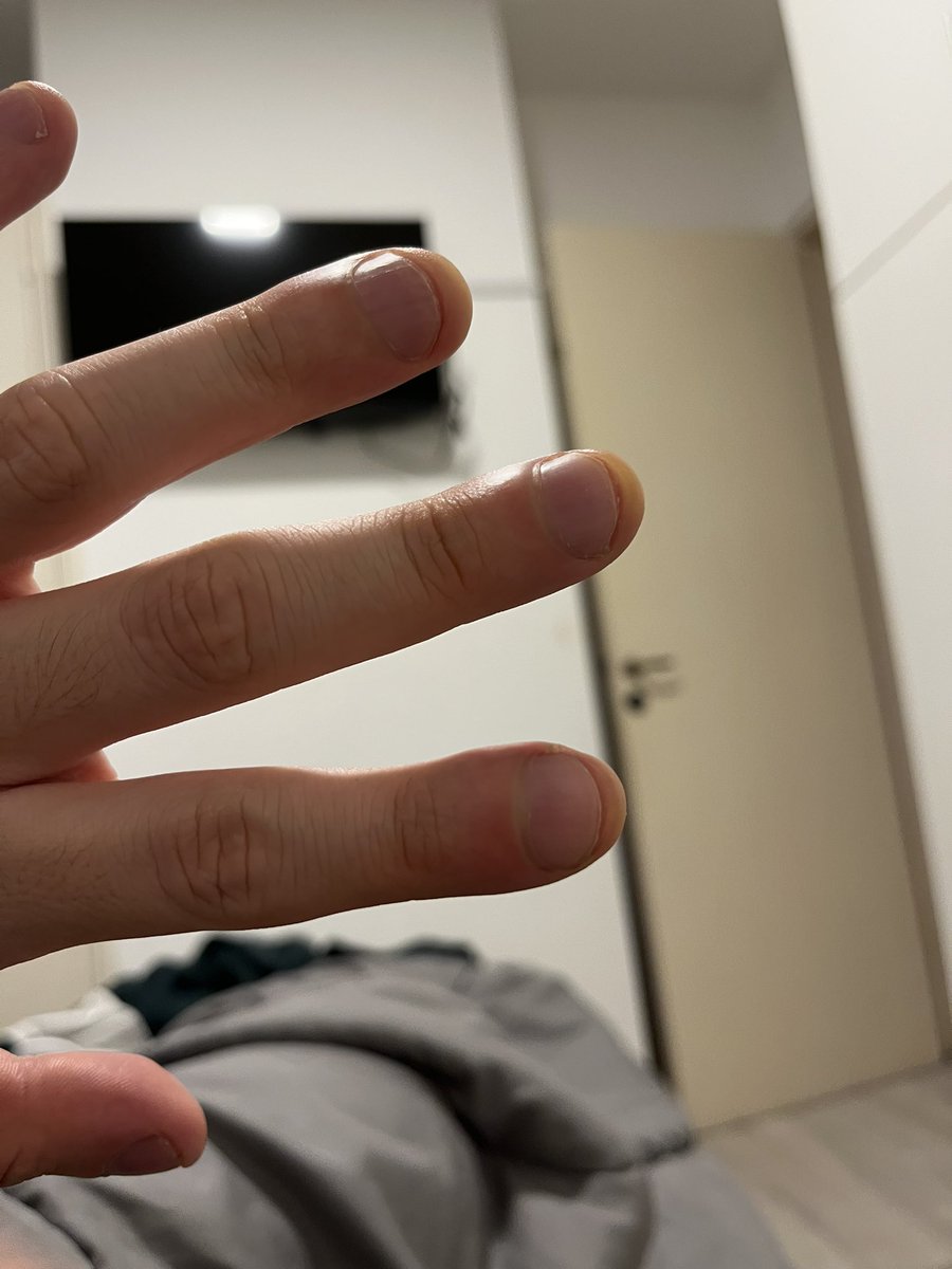 Nachoide🎄 tweet media