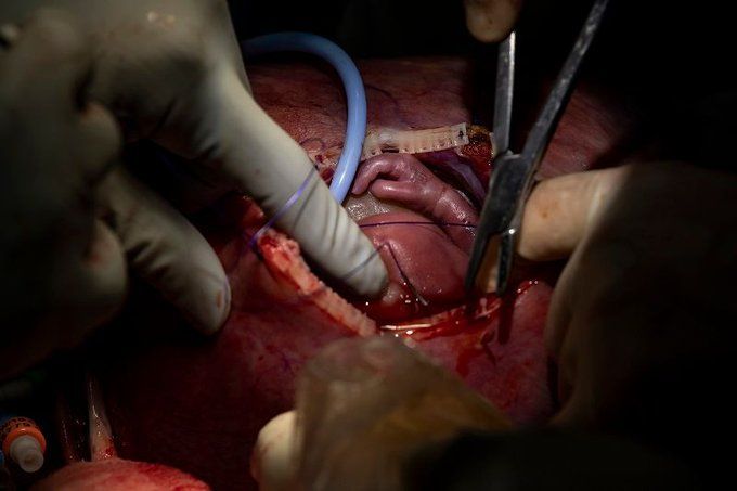 LifeNews.com tweet media