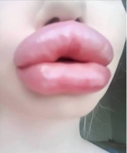 𝓔𝓧𝓣𝓔𝓝𝓓𝓔𝓡 tweet media