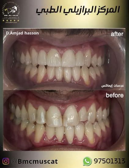 المركز البرازيلي الطبي ( أسنان) مسقط 🇴🇲 tweet media