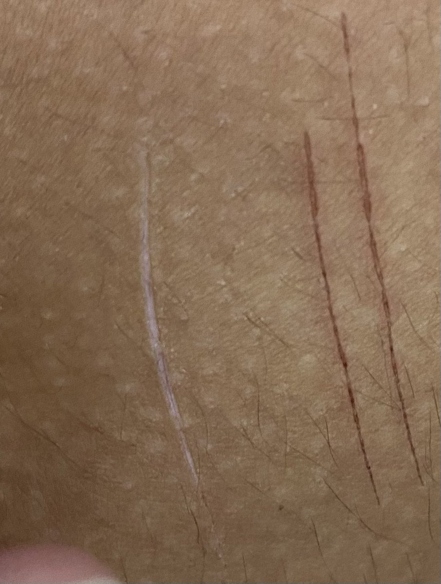 bkdk of shedtwt ‧˚꒰🐾୭ ˚. ᵎᵎ tweet media