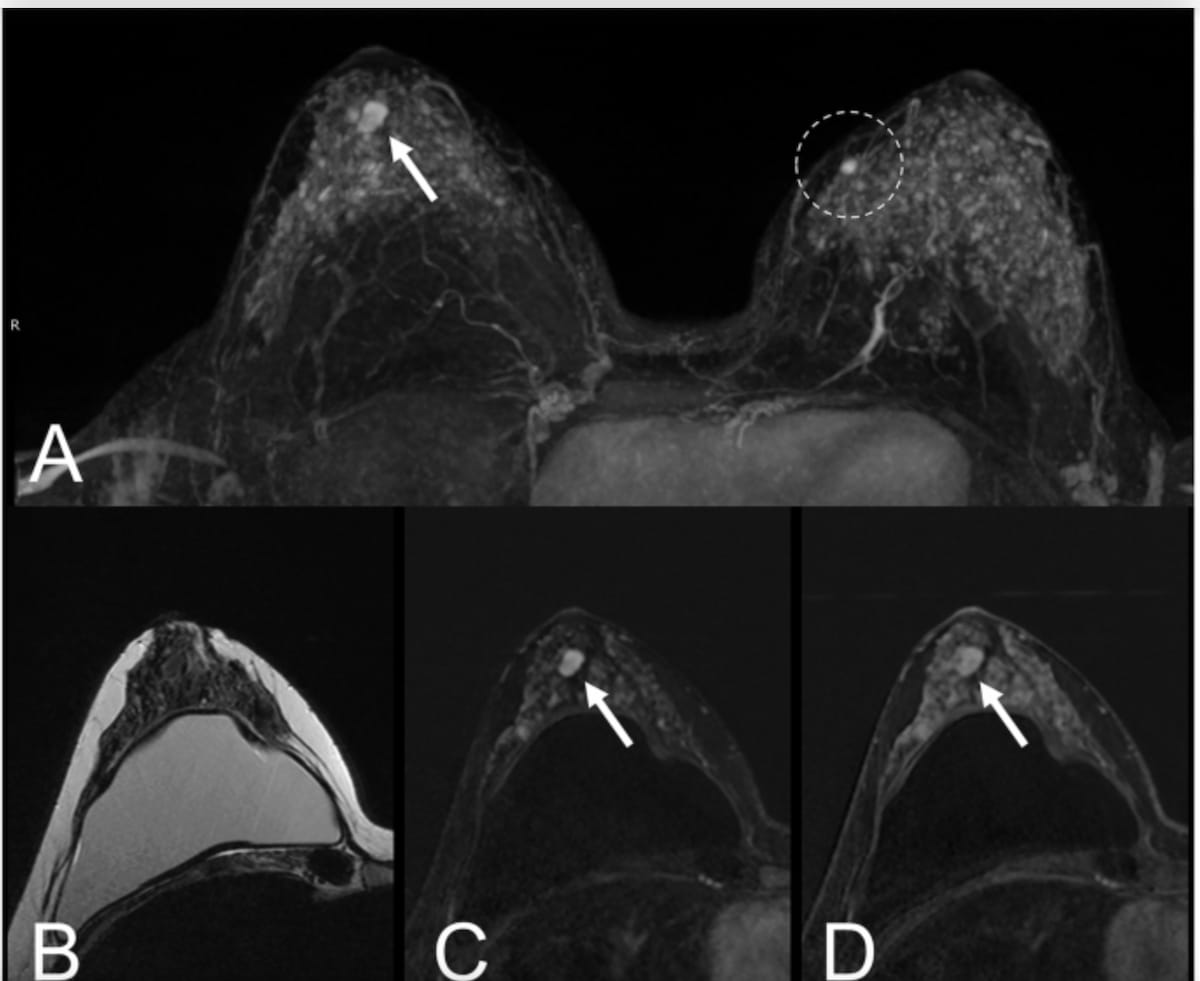 Diagnostic Imaging tweet media