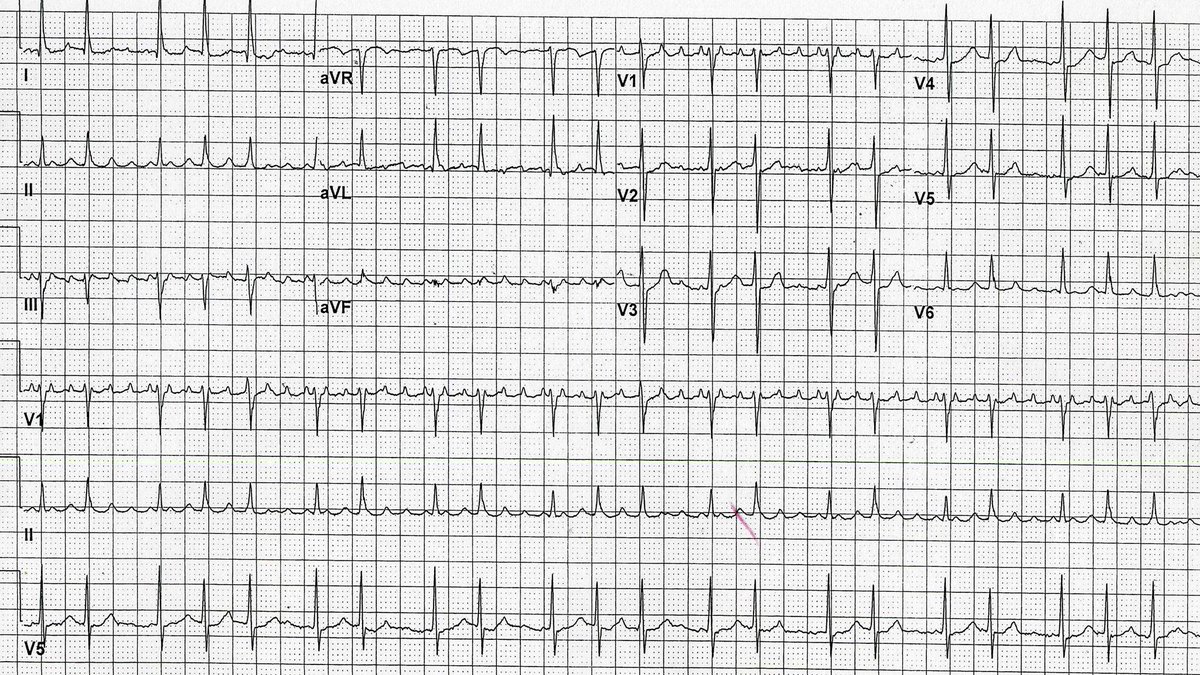 Philip J Podrid MD tweet media