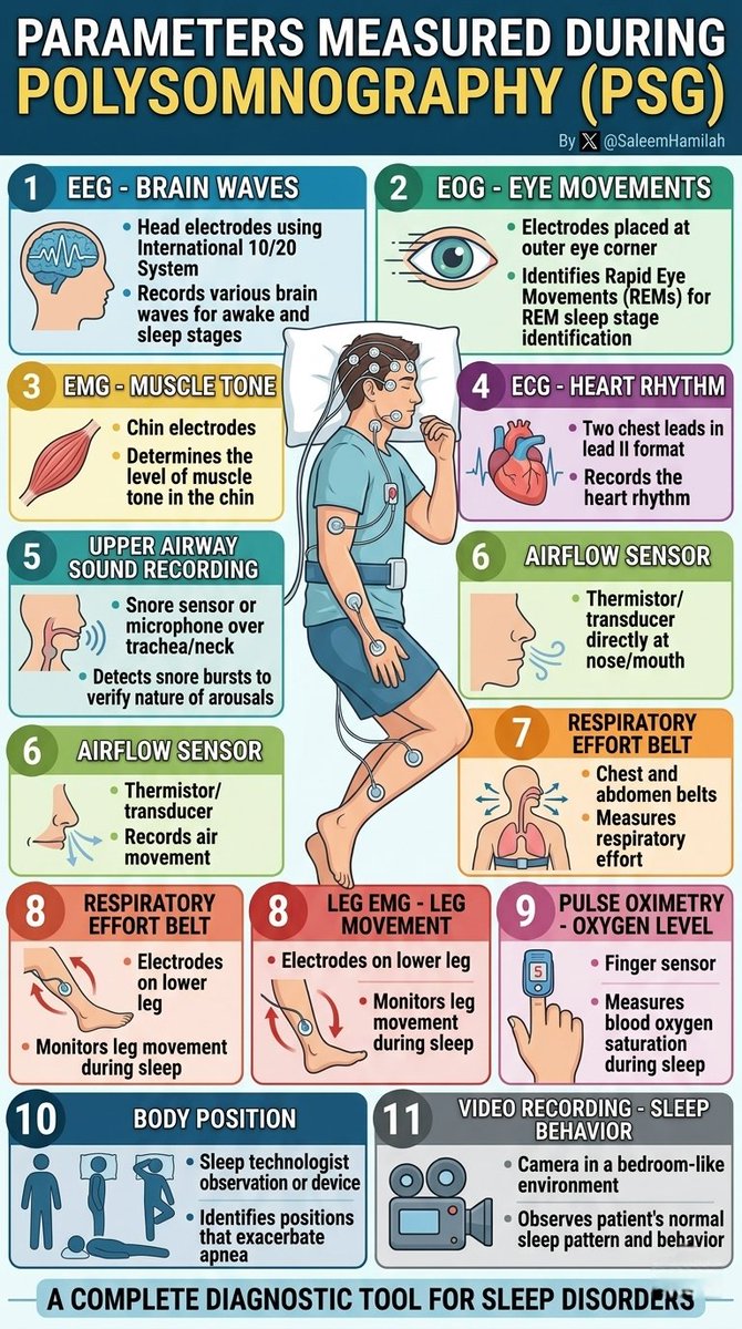 SaleemHamilah's tweet image. PARAMETERS MEASURED DURING POLYSOMNOGRAPHY (PSG).

By  Saleem N. Hamilah 

 #sleepmedicine #SleepDisorders #sleepapnea #obstructivesleepapnea #Polysomnography #RPSGT