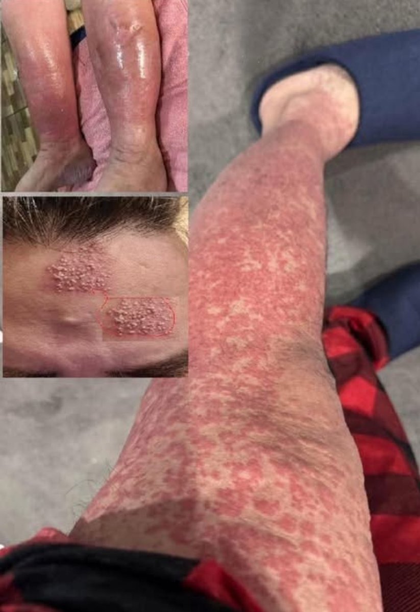 💣Reactive Ray /Harry Knocka👊🏿 tweet media