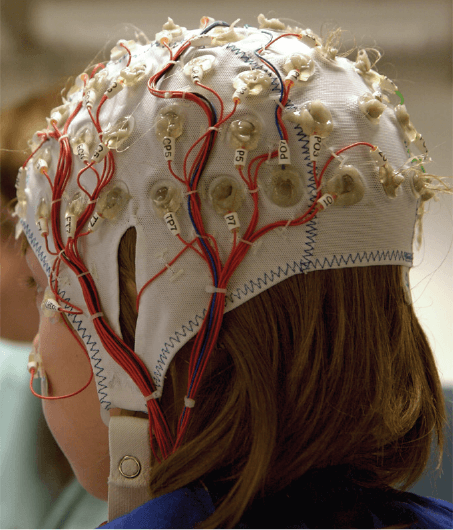 Brain & Life tweet media