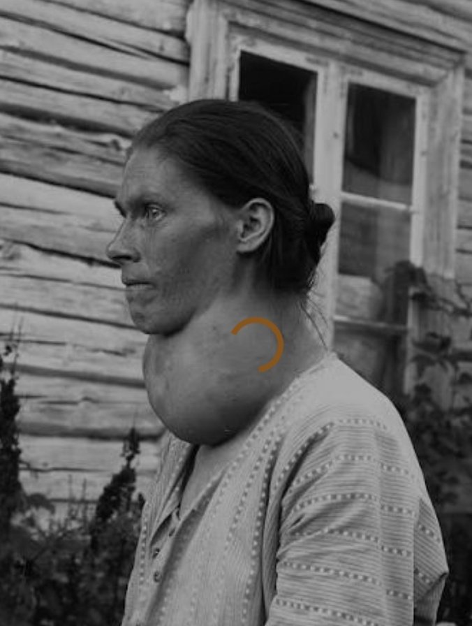 dokterbedahYK tweet media