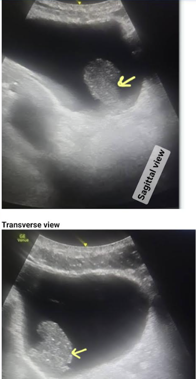 Ahmed T Abdellah tweet media