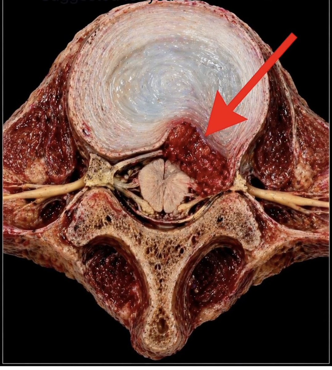 Oren Gottfried, MD tweet media