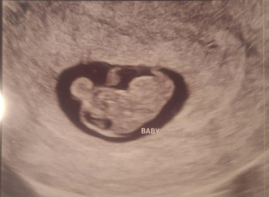 Sarah Fields tweet media