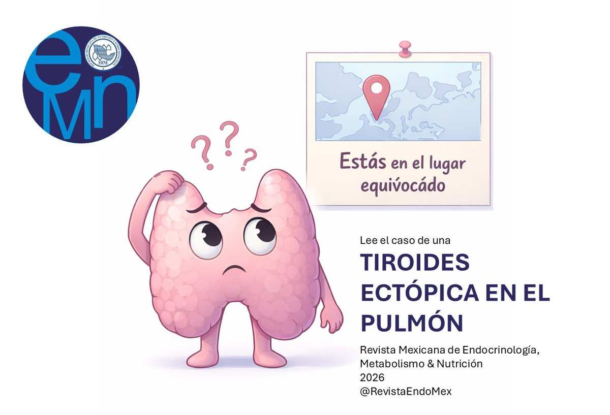 RevistaEndoMex's tweet photo. Tiroides ectópica pulmonar #thyroid #clinicalcase en la Revista Mexicana de Endocrinología Metabolismo & Nutrición @RevistaEndoMex Acceso en 👉 https://t.co/LkvwwiyawM Comparte con tus colegas y discute la #CienciadeCalidad #ectopic #pathology #CTscan https://t.co/lQv24XqB0Y