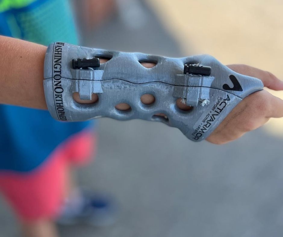 ActivArmor's tweet image. "My ActivArmor cast is on and very comfortable!"
#ActivArmor #GolfLife #AthleteRecovery #SportsMedicine #CustomCasts #MedTech #JuniorGolfPro #WaterproofCast #brokenwrist