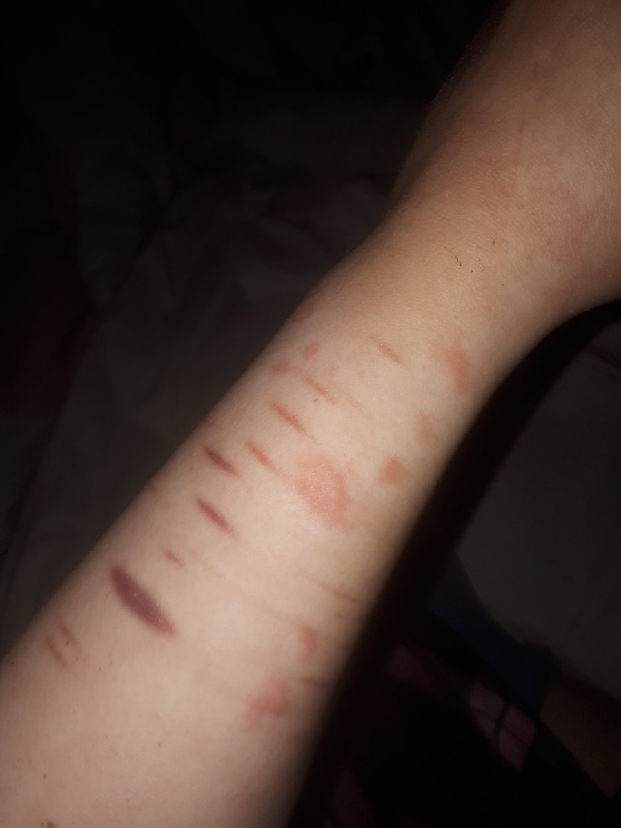 🅁🄸🄽₊˚⊹ᰔ tweet media