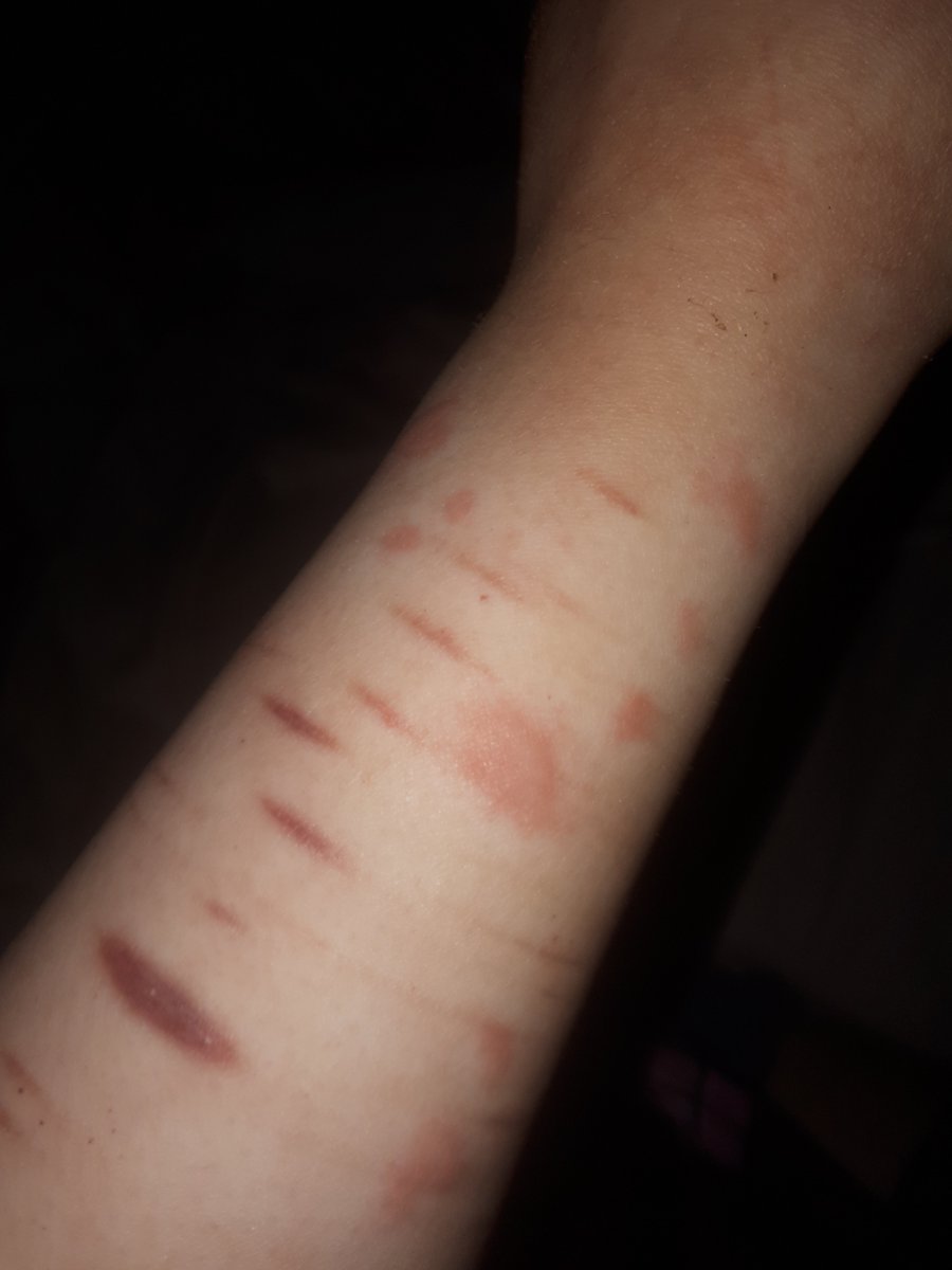 🅁🄸🄽₊˚⊹ᰔ tweet media