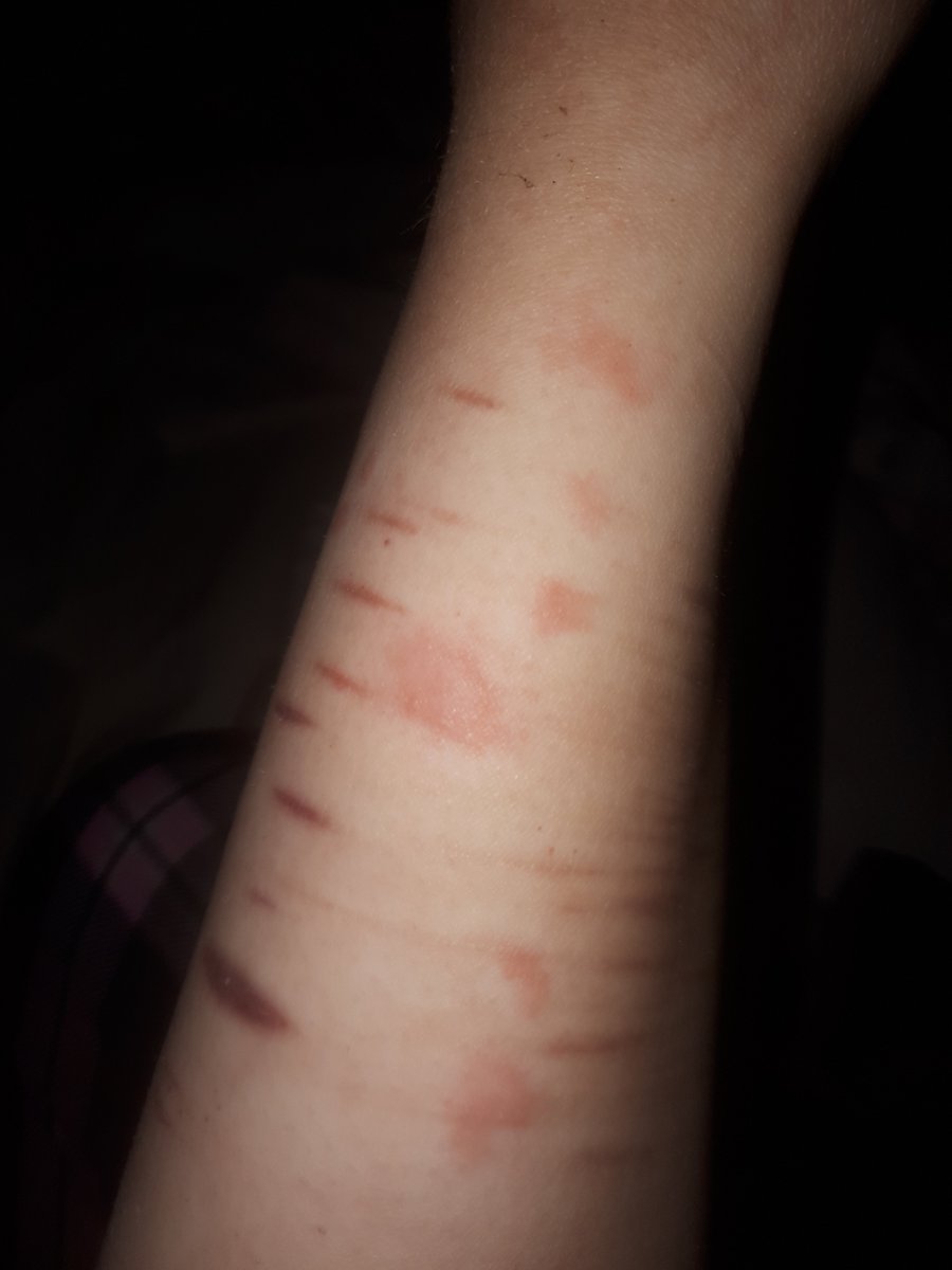 🅁🄸🄽₊˚⊹ᰔ tweet media