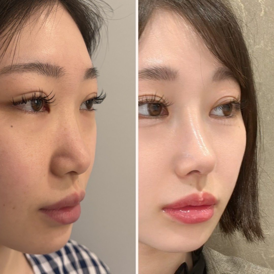 生肉 4/28〜4/29渡韓🇰🇷 tweet media