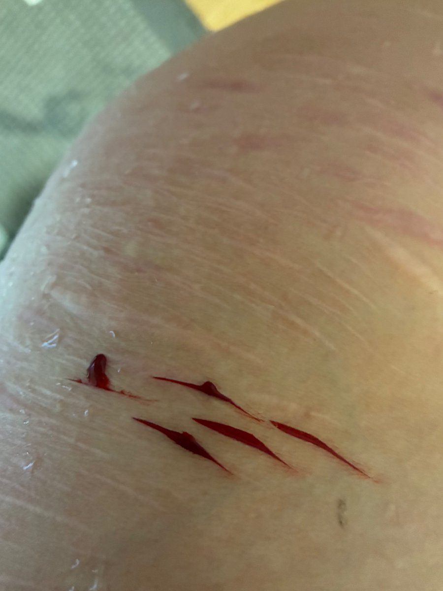 × ...blake shtwt .ᐣ.ᐟ tweet media