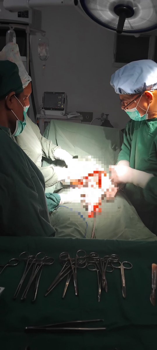 En la urgencia, la experiencia y la rapidez marcan la diferencia. El Dr. Leandro Núñez, especialista en Ginecobstetricia y miembro de la #BMCTL #HROecusse, realiza cesárea de urgencia, garantizando la seguridad materno-infantil con profesionalismo y entrega.
#CubaPorLaVida