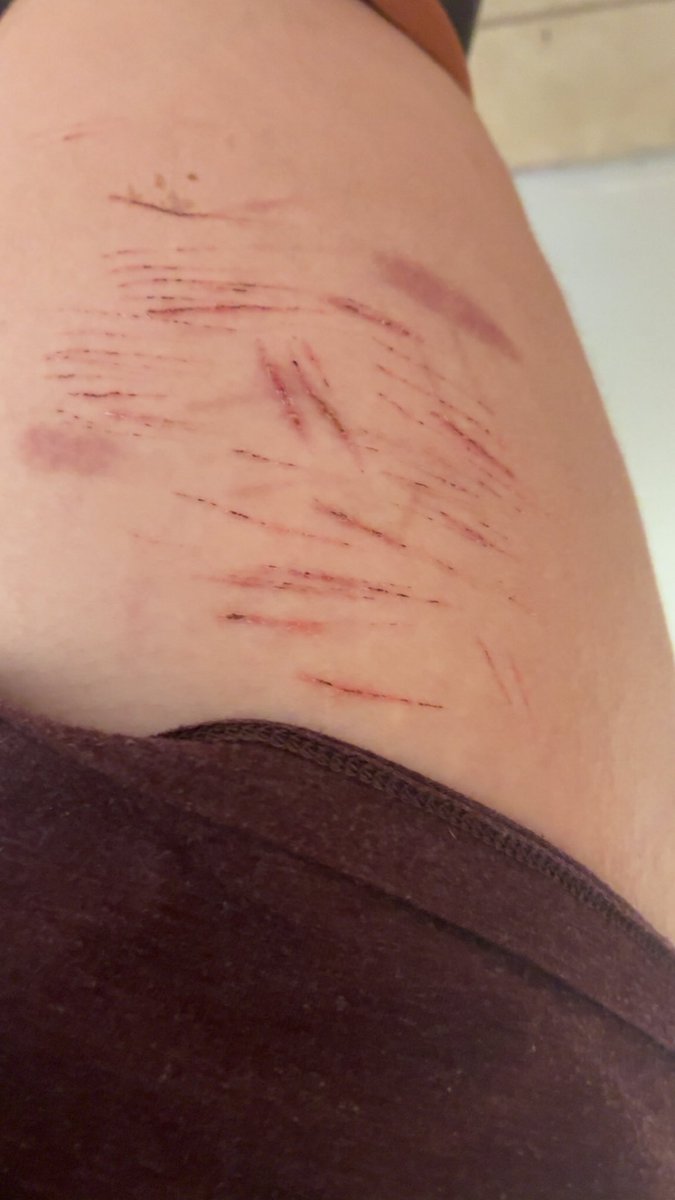 Echo🤍 tweet media