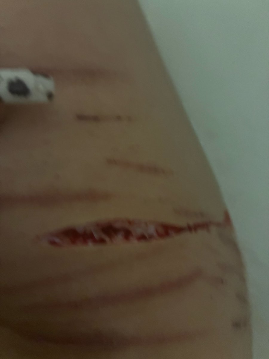 Anoni of shedtwt 🌈💊 tweet media