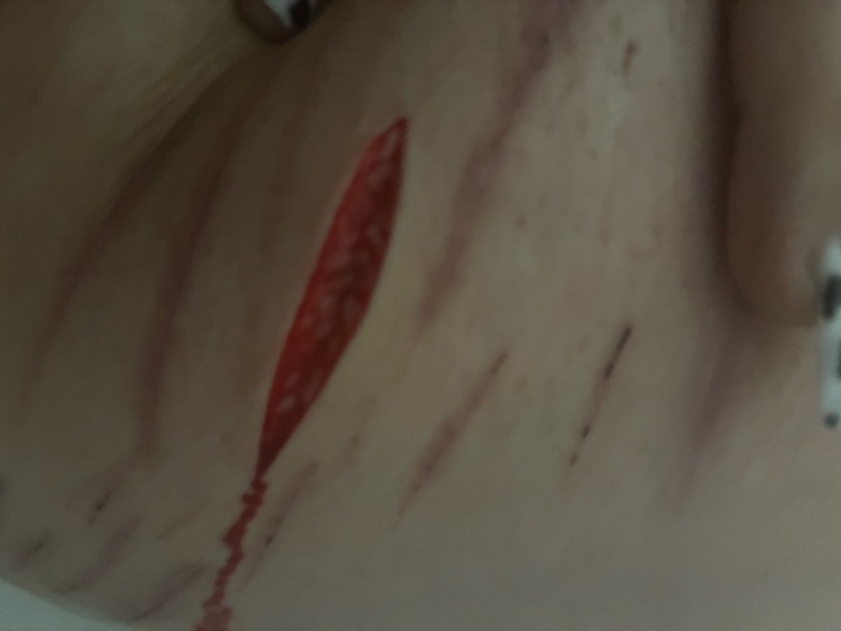 Anoni of shedtwt 🌈💊 tweet media