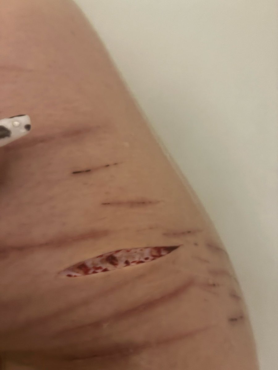 Anoni of shedtwt 🌈💊 tweet media