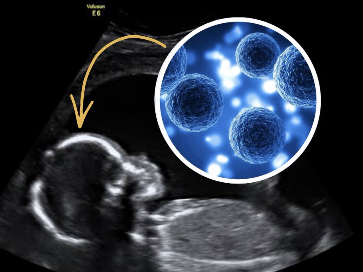 Mediavrai tweet media