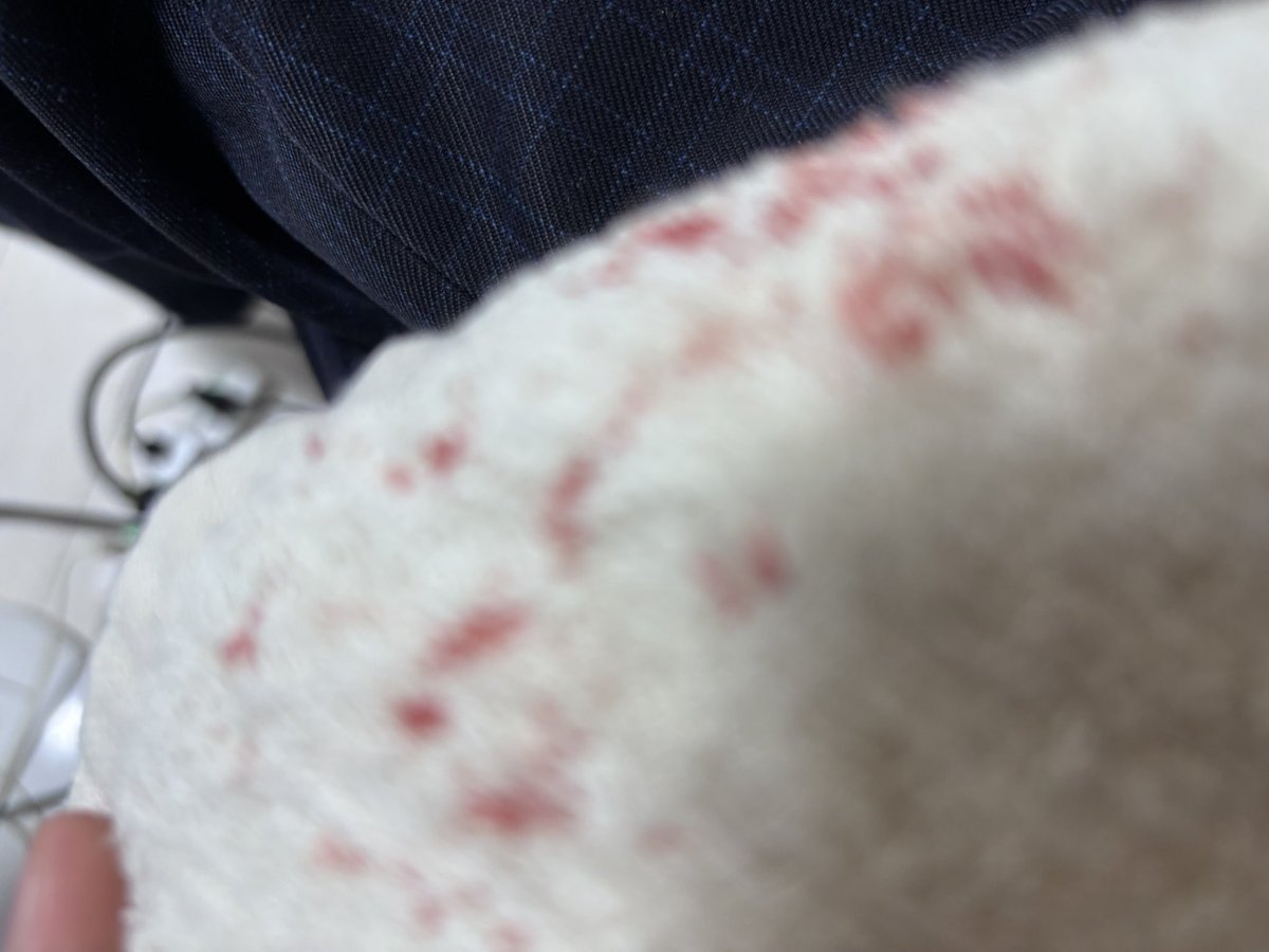 OPEINSIA tweet media