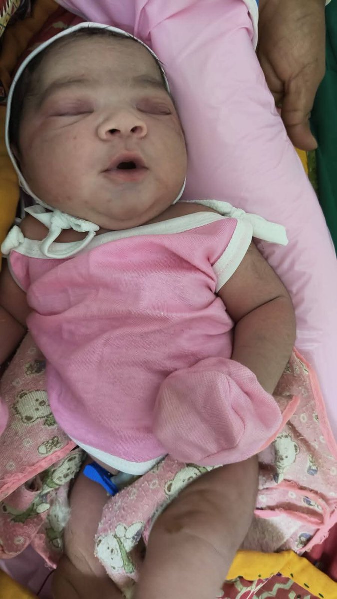 CdhoSabarkantha's tweet image. #WorldHealthDay 
 સામૂહિક આરોગ્ય કેન્દ્ર તલોદ ખાતે 4 કિલો અને 300 ગ્રામનિ બાળકી નો નોર્મલ પ્રસૂતિ ધ્વારા જન્મ કરાવવામાં આવ્યો.
માતા તથા બાળકી તંદુરસ્ત.
નવજાત શિશુ ને જન્મસમય ની તમામ રસી અપાઈ.
#healthcare 
#healthforall 
#swasthbharat