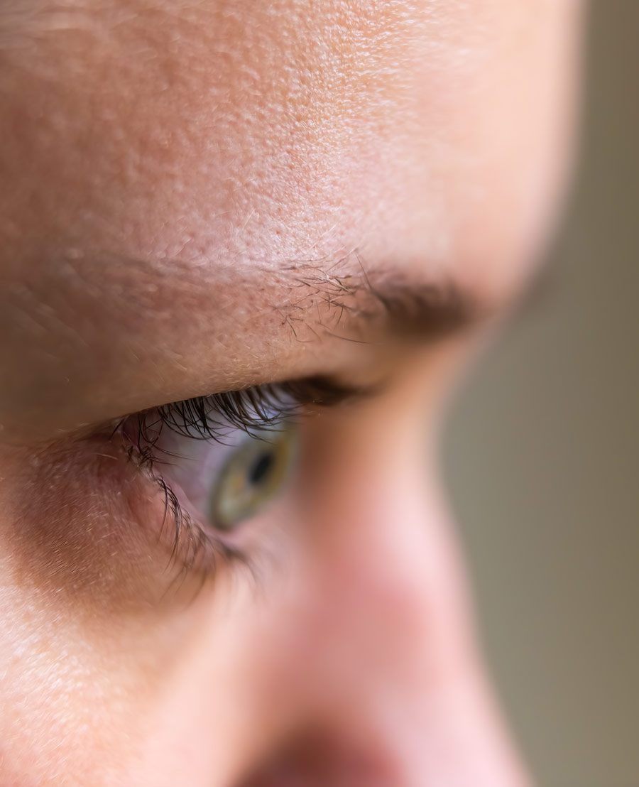 nikodem1227's tweet photo. your eyebrows thinning on the sides isn't aging

it's your thyroid shutting down non essential systems

and everyone's ignoring it 

🧵: https://t.co/7og3fAC1zi