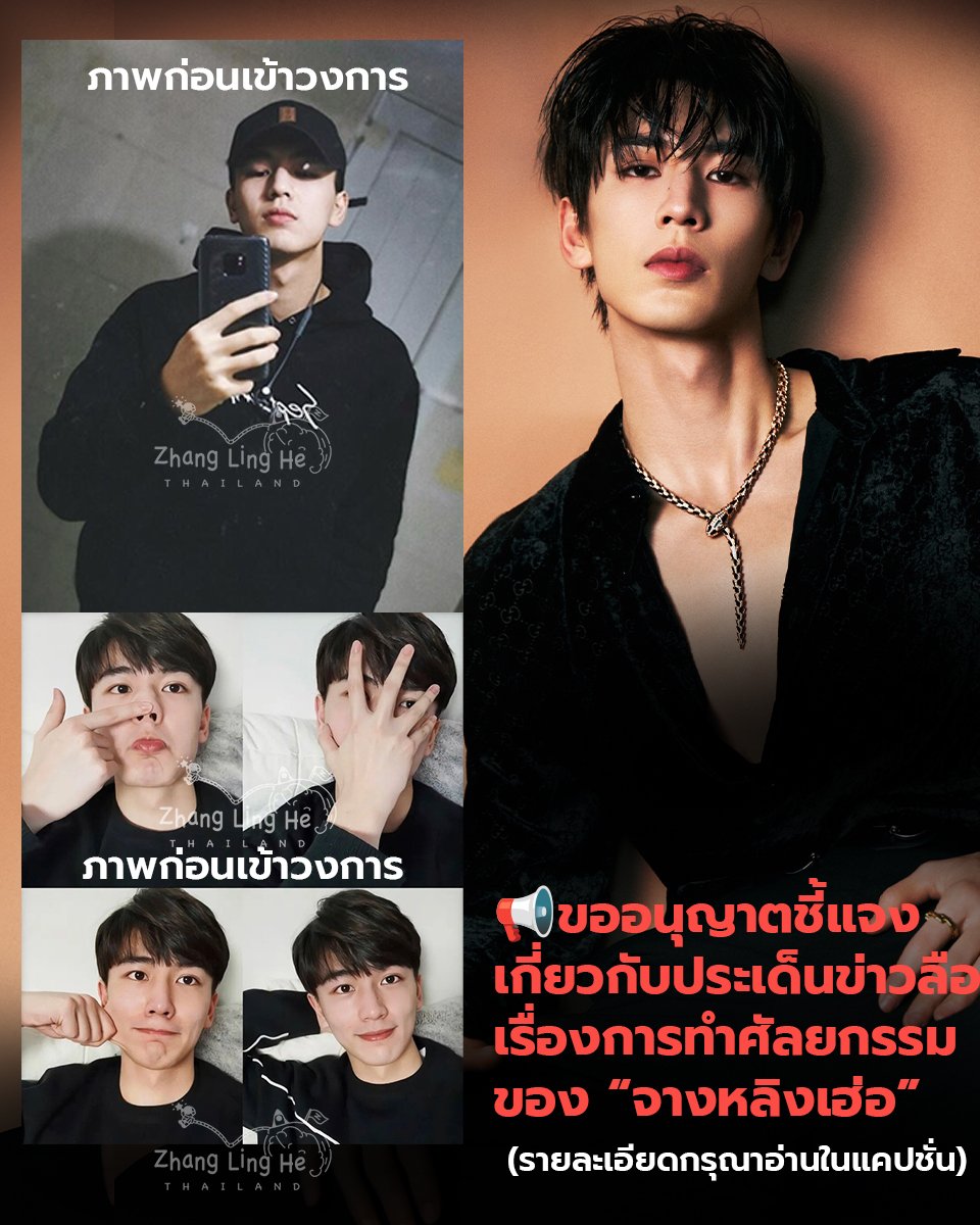 📢 ขออนุญาตชี้แจงเกี่ยวกับประเด็นข่าวลือเรื่องการทำศัลยกรรมของ “จางหลิงเฮ่อ”

ตามที่มีการเผยแพร่ข้อมูลและข้อสันนิษฐานในสื่อสังคมออนไลน์เกี่ยวกับประเด็นการทำศัลยกรรมของศิลปิน “จางหลิงเฮ่อ” ซึ่งอาจก่อให้เกิดความเข้าใจคลาดเคลื่อนในหมู่ผู้ติดตามและสาธารณชน ทางบ้านแฟนคลับ