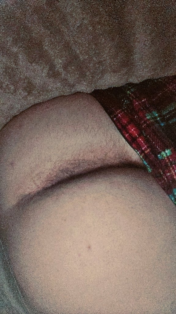 Coz_mic0's tweet photo. Which do you prefer? 🍑 or 🍆 
I can never make up my mind!🤣😉 https://t.co/Rvyt8mOmLC