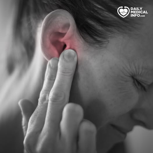 معظم التهابات الأذن تشفى خلال 3 أيام، وللمساعدة في تخفيف أي ألم وعدم الراحة من التهاب الأذن يمكنك محاولة الآتي: -استخدم مسكنات الألم مثل الباراسيتامول أو الإيبوبروفين. -ضع قطعة من القماش دافئة أو باردة على الأذن. -إزالة أي إفرازات عن طريق مسح الأذن بقطعة من القطن. 