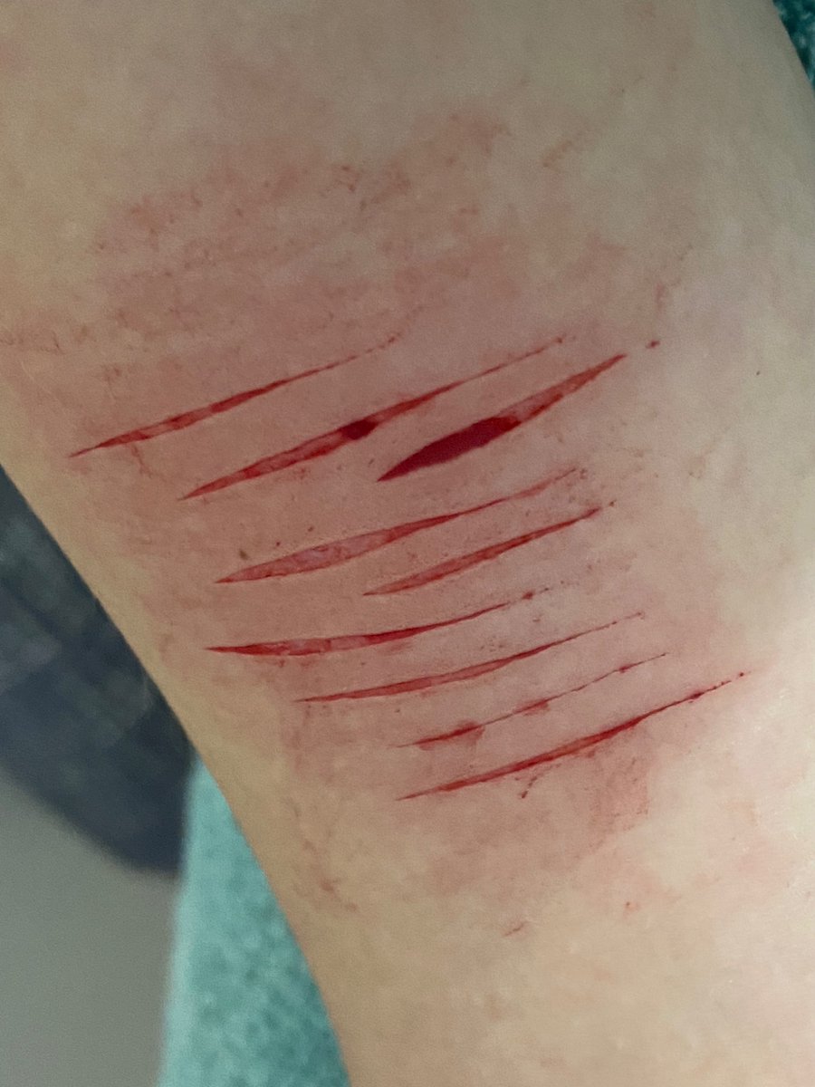 Dark Age Dazai of SHEDTWT tweet media