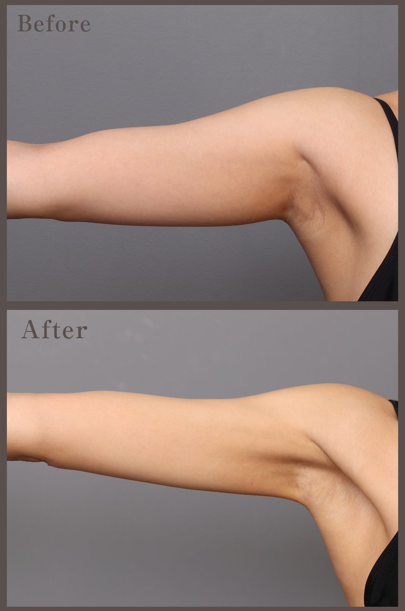 志田雅明 美容外科医|ハイブリッド豊胸・バービーウエスト・脂肪吸引・脂肪豊胸 tweet media