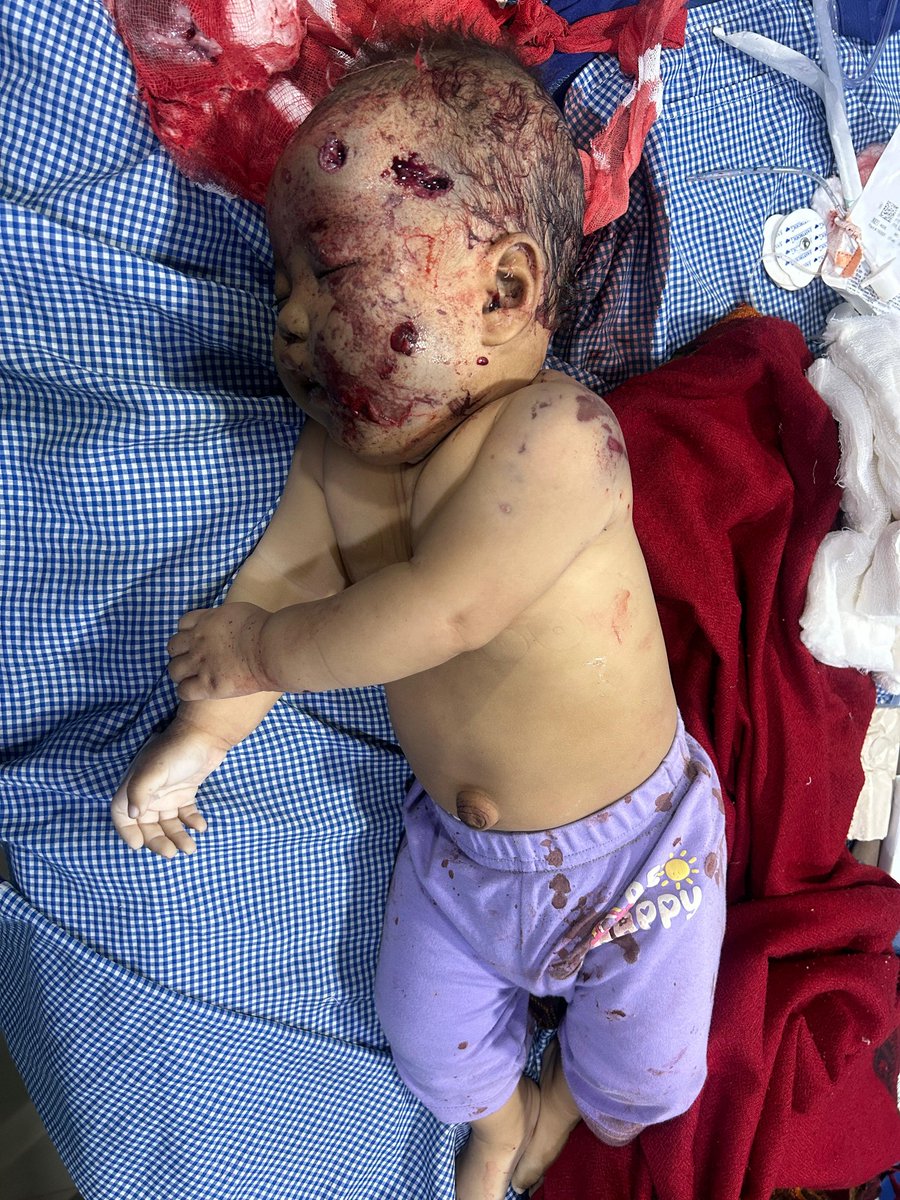 JJohnnymeitei tweet media