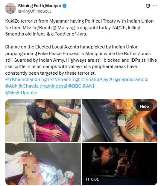 Toshinali Lotha tweet media