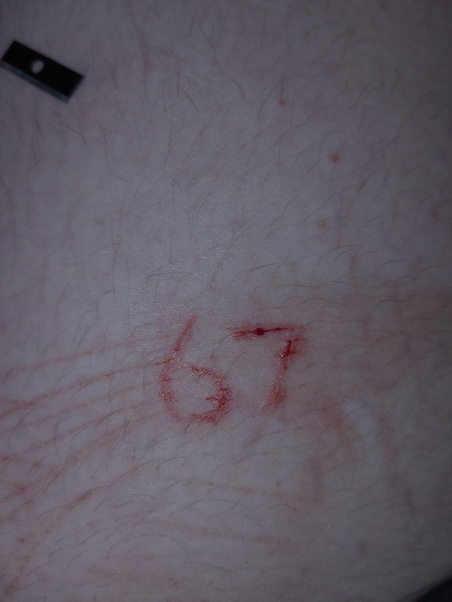 𝓯𝓻𝓮𝓪𝓴𝔂 Trinity Santos of Shtwt tweet media