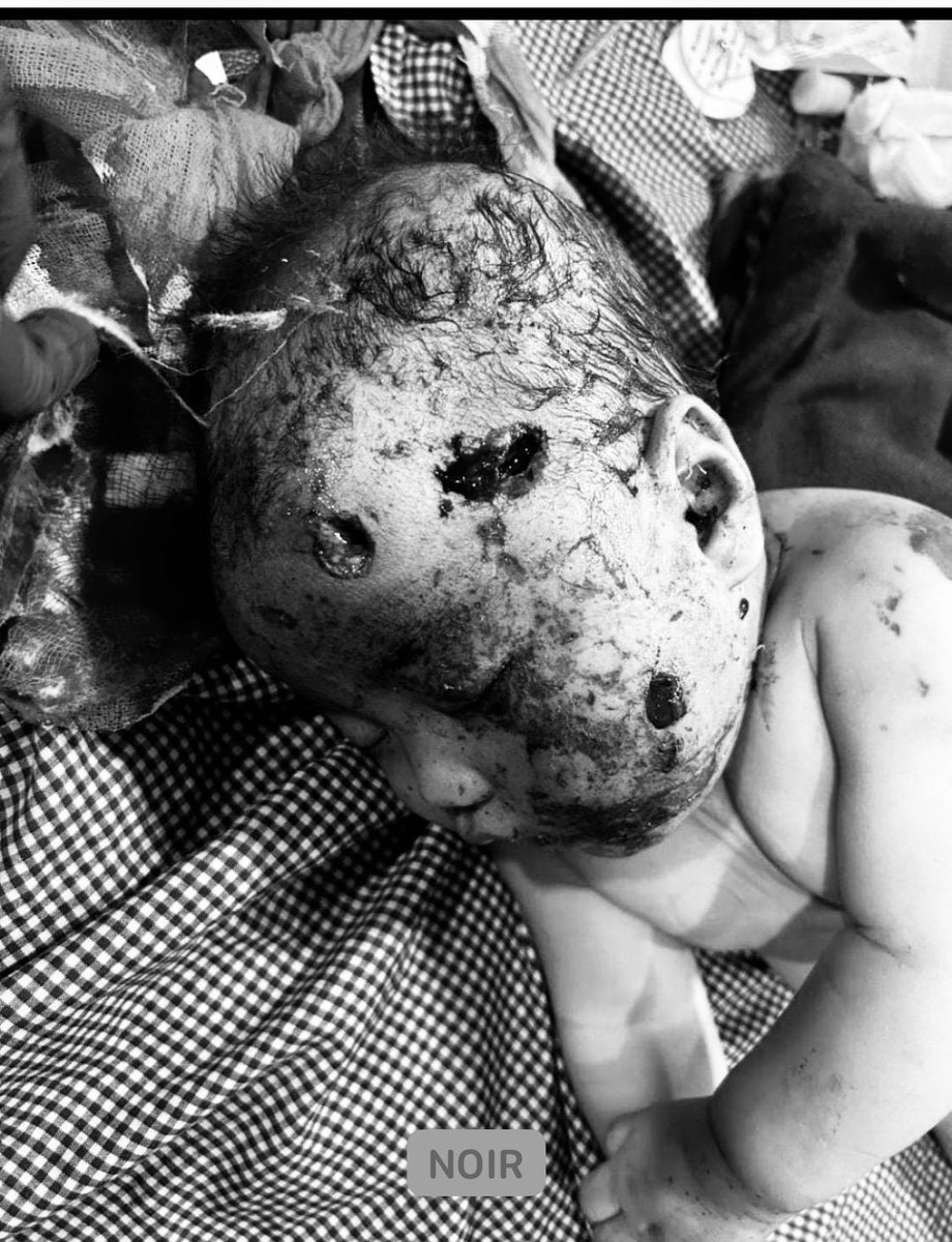 BeeThangjam tweet media