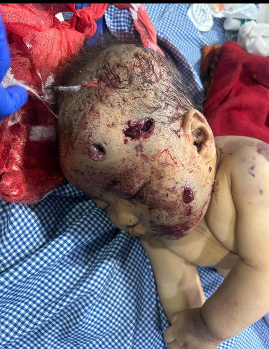 LThang28110's tweet photo. #TomthinOinam playing with her little sister #LeisanaOinam before their home was bombarded by armed #KukiTerrorists (left). Right: their lifeless bodies, faces and heads shattered by the attack. Such cowardly acts echo the brutality we see in Palestine. 
#JusticeforInnocent https://t.co/GdU8Rg01Re