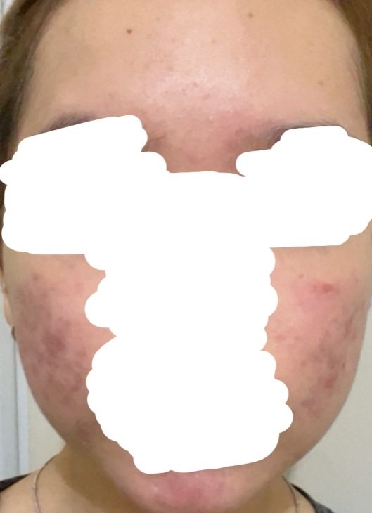 ✨OMBB | 🚫NO LINK tweet media