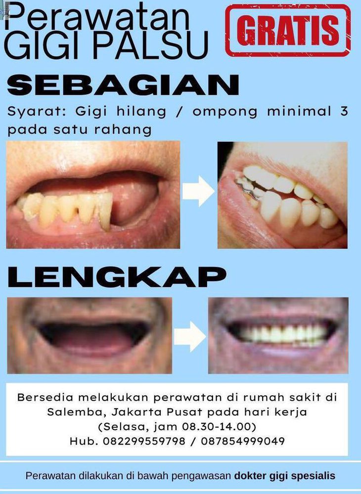 KOAS GIGI tweet media