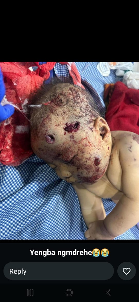 MEGHARAJ LAIRIKYENGBAM tweet media